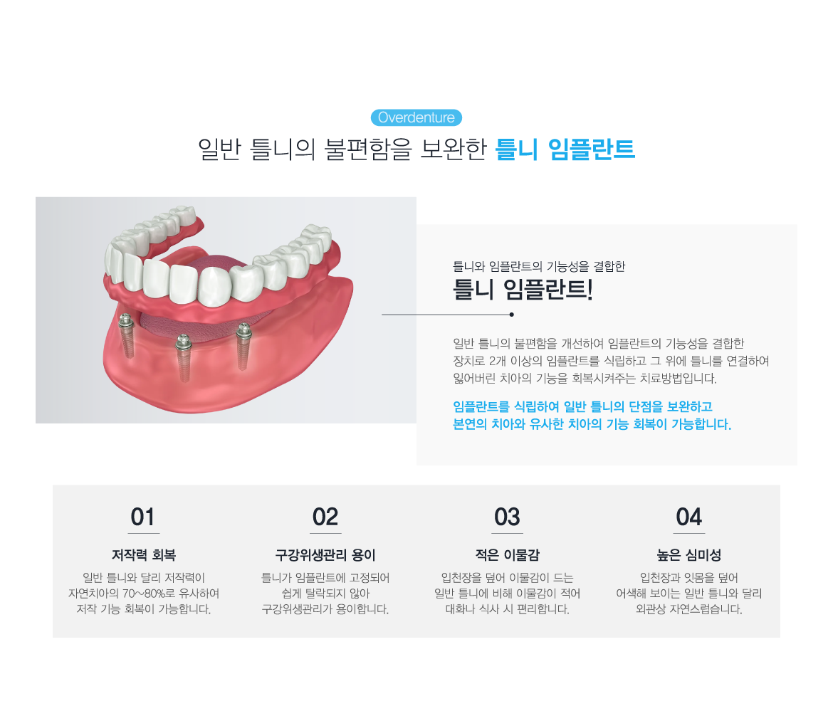 Ʋ�����ö�Ʈ