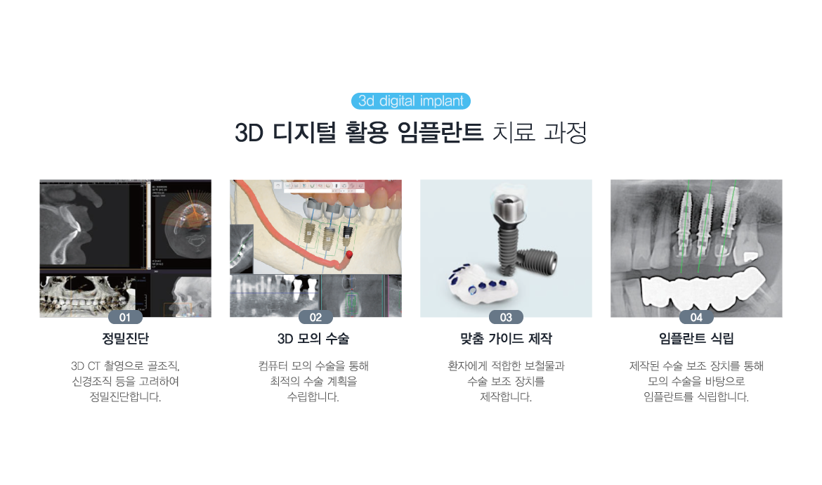 �׺���̼����ö�Ʈ ġ�� ����