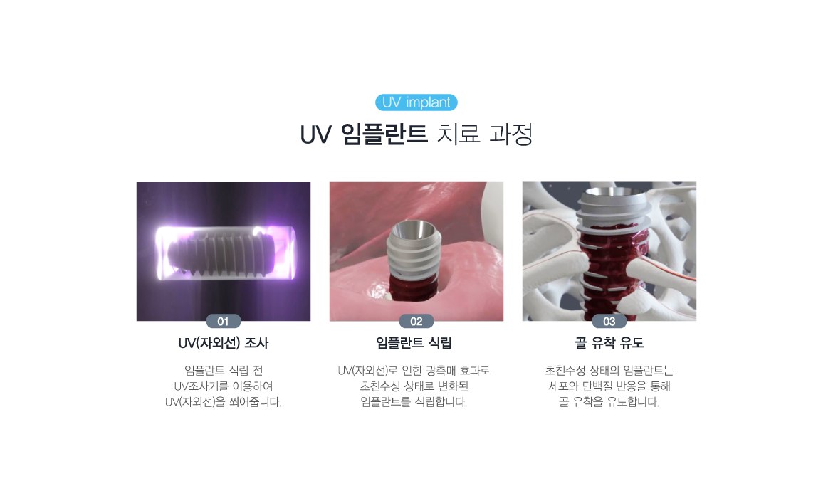 uv���ö�Ʈ ġ�� ����