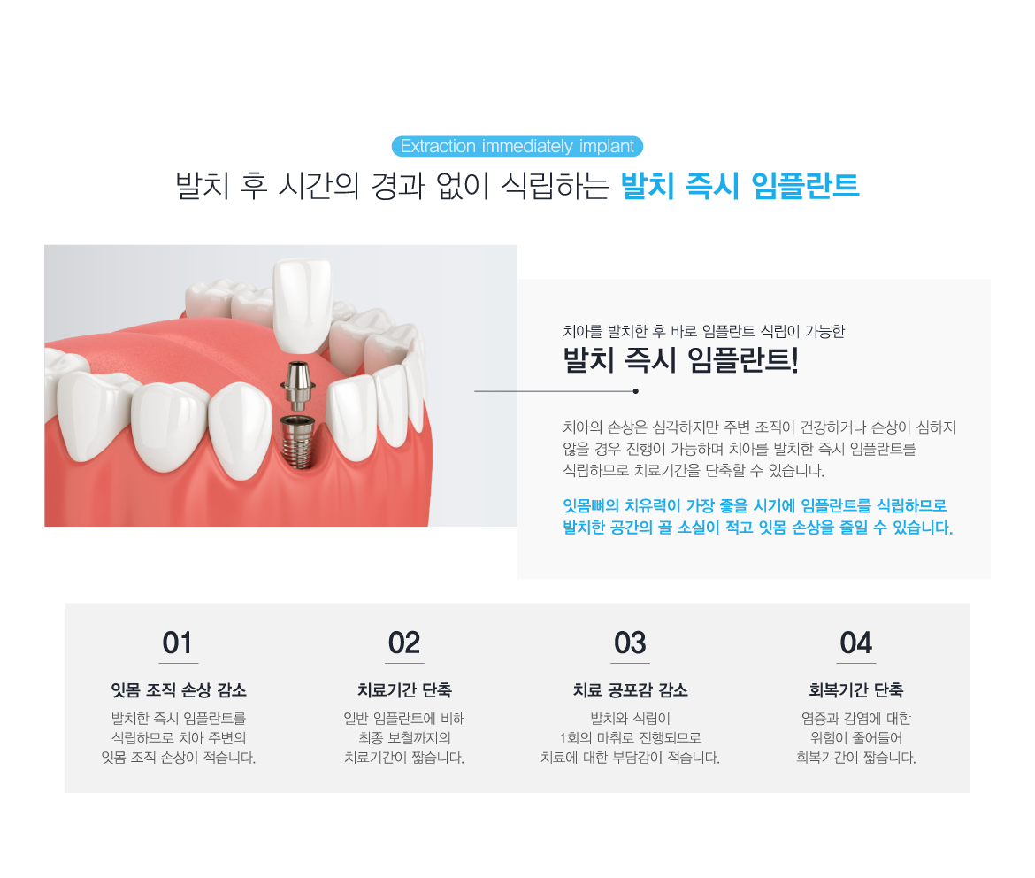 ��ġ������ö�Ʈ