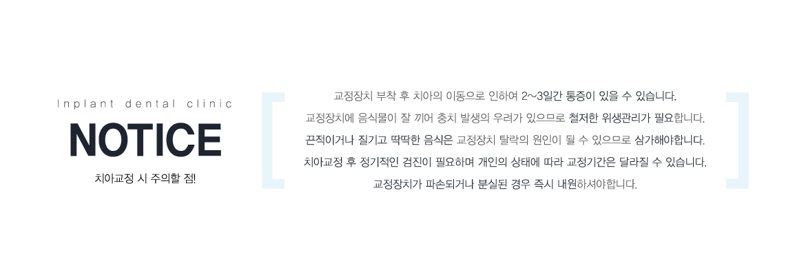 ġ�Ʊ��� �� ������ ��