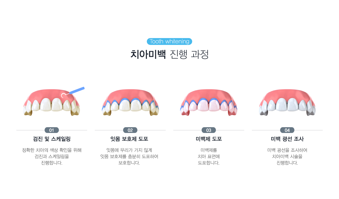 ġ�ƹ̹� ���� ����