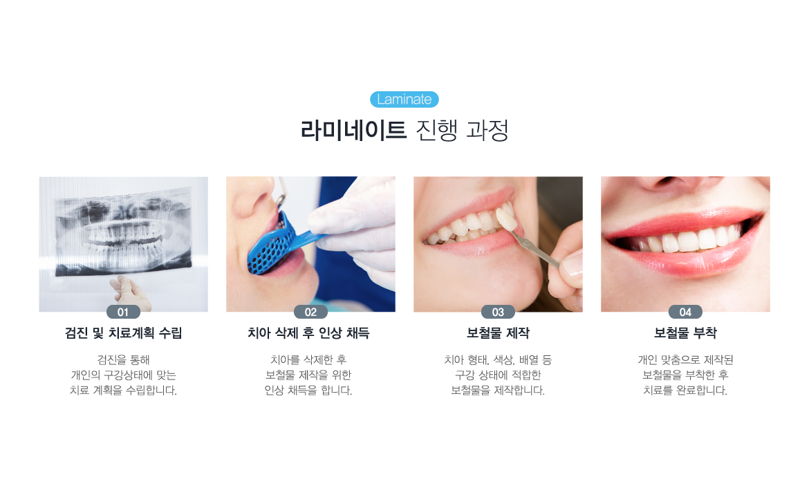 ��̳���Ʈ ���� ����