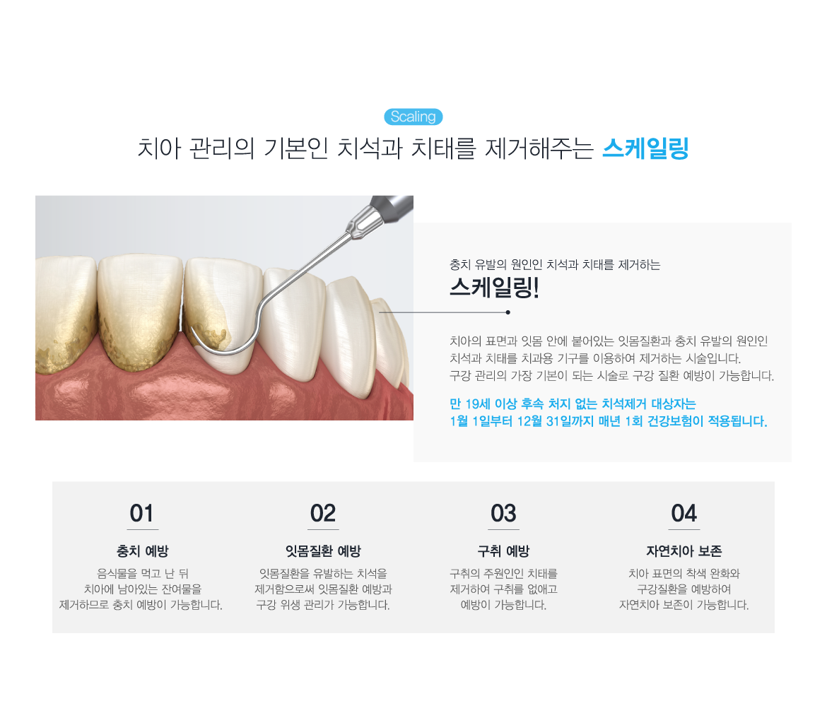 �����ϸ�