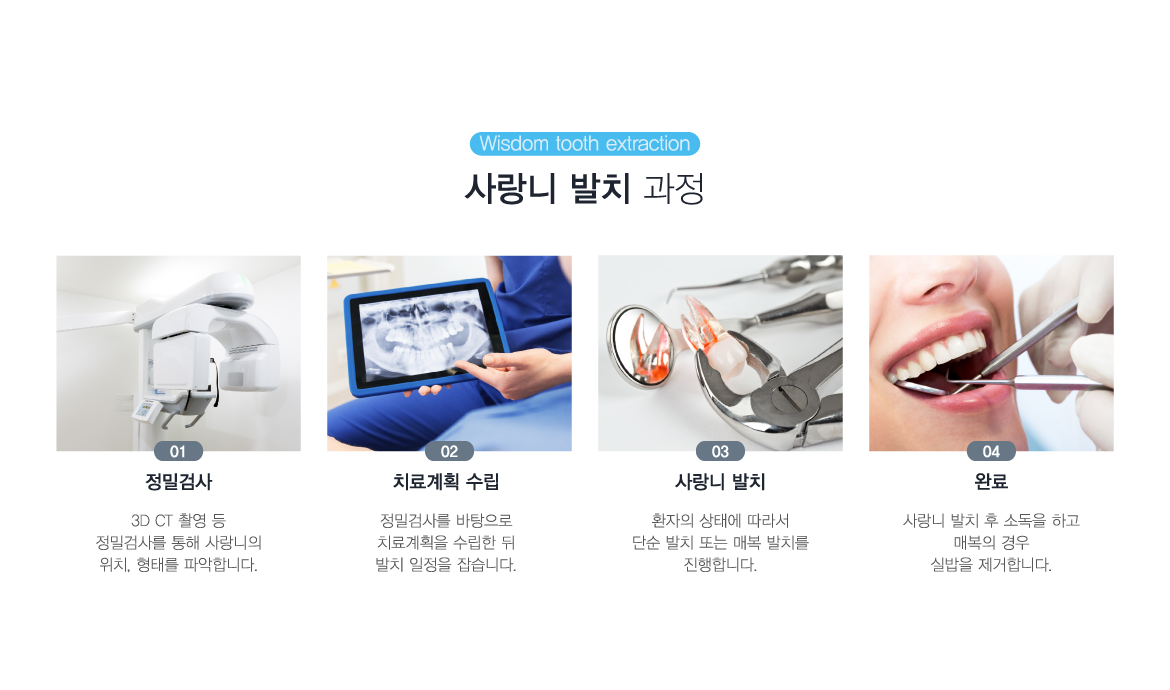 ����� ��ġ ����