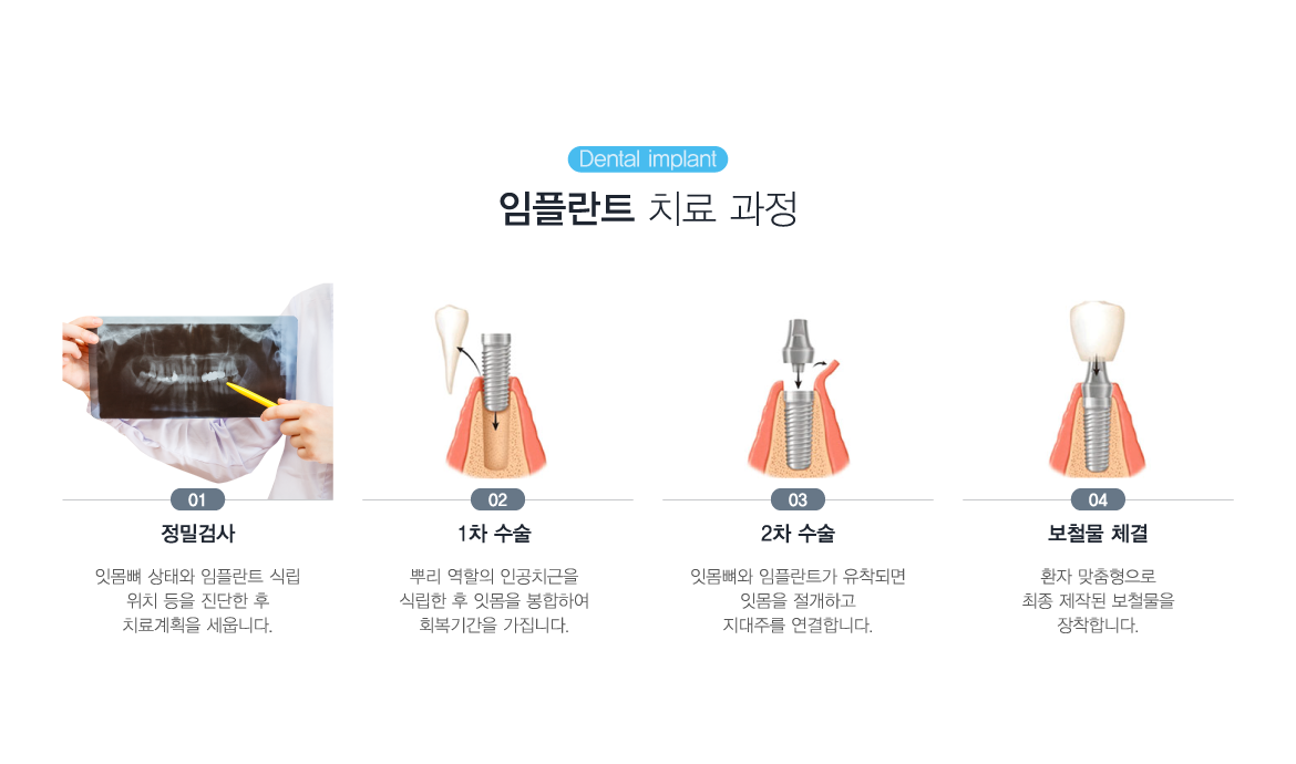 ���ö�Ʈ ġ�� ����