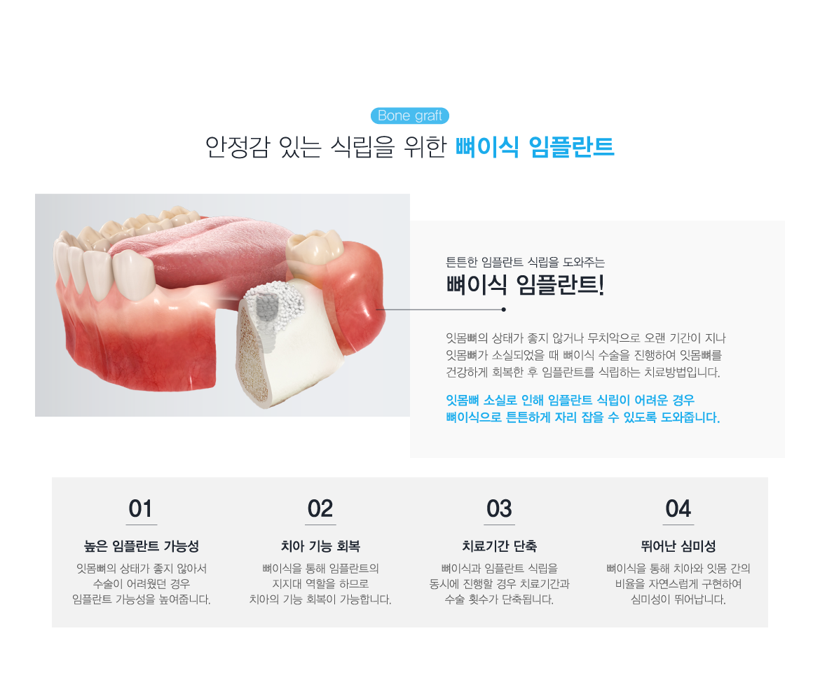 ���̽����ö�Ʈ