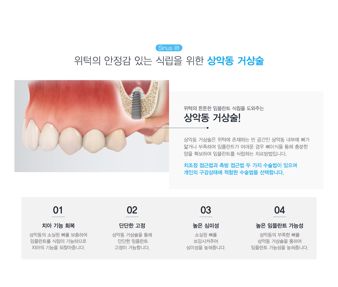 ��ǵ� �Ż��