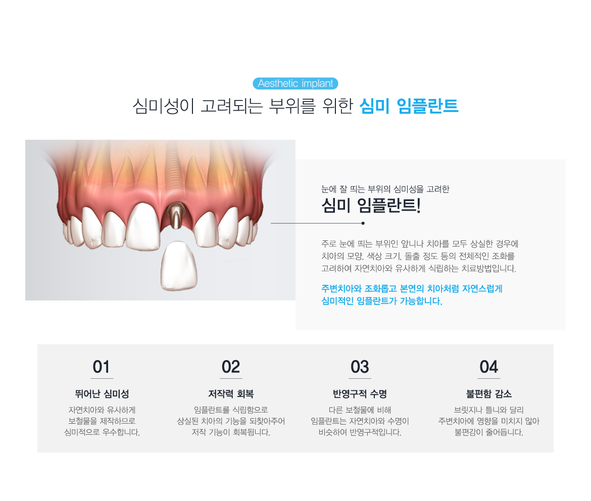 �ɹ����ö�Ʈ