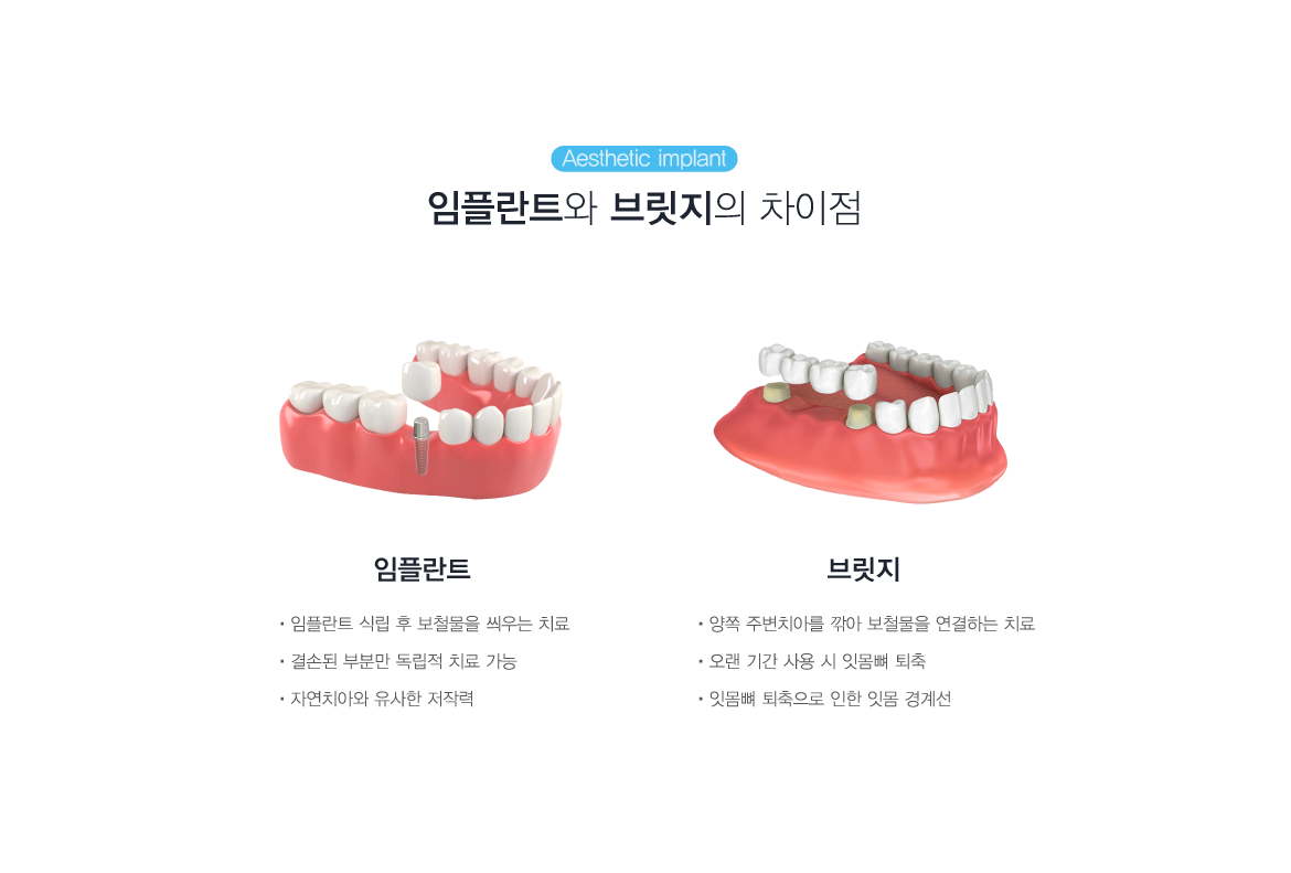 ���ö�Ʈ�� �긴���� ������