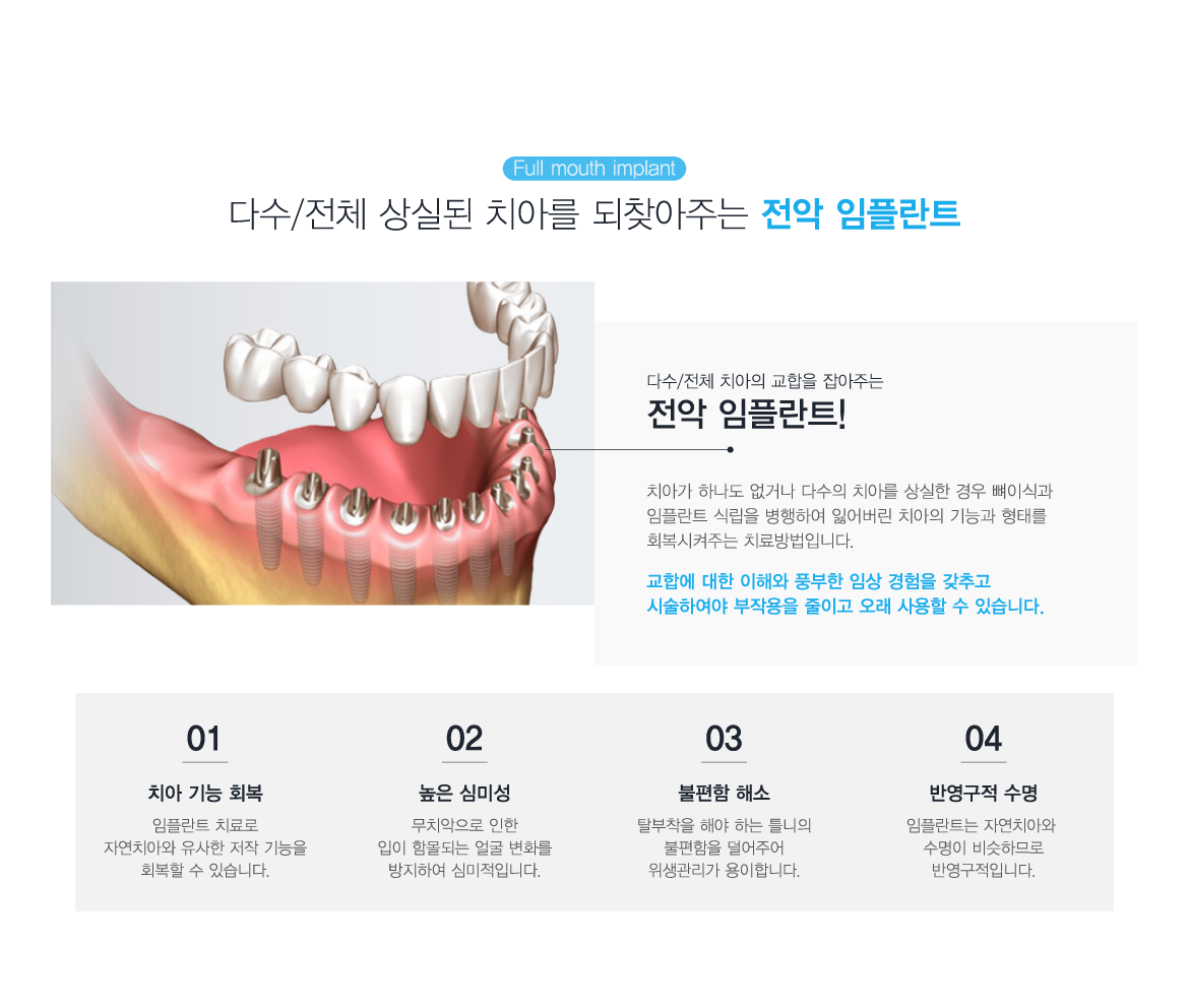 ���� ���ö�Ʈ