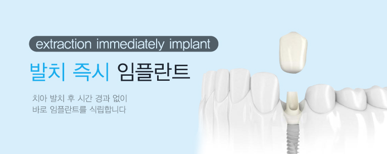 ��ġ������ö�Ʈ